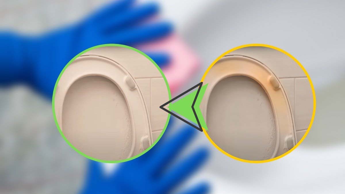 ¿El asiento del váter está completamente amarillento? ¡Aquí tienes el remedio natural para volverlo blanco en segundos!