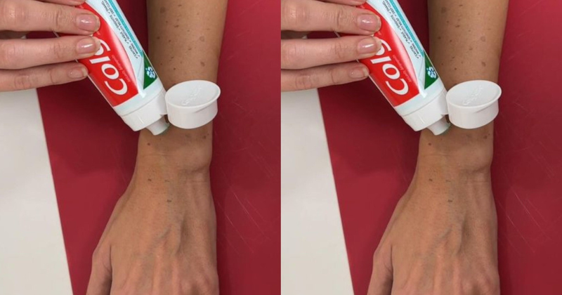 Remedio casero innovador: use pasta de dientes para aclarar las manchas de la edad