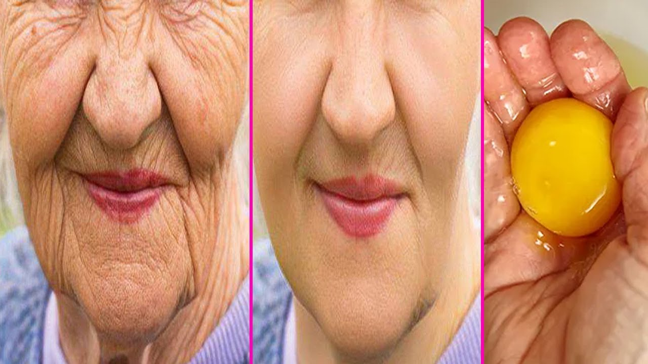 7 máscaras faciales blancas de huevo implacables para pieles problemáticas