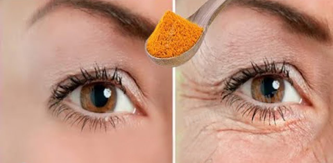 Crema natural con aceite de coco para rejuvenecer el contorno de ojos