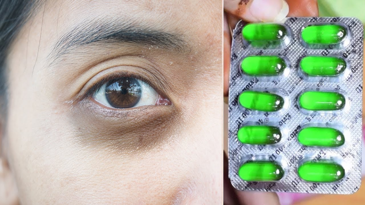 Elimina las ojeras con esta crema natural para ojos casera