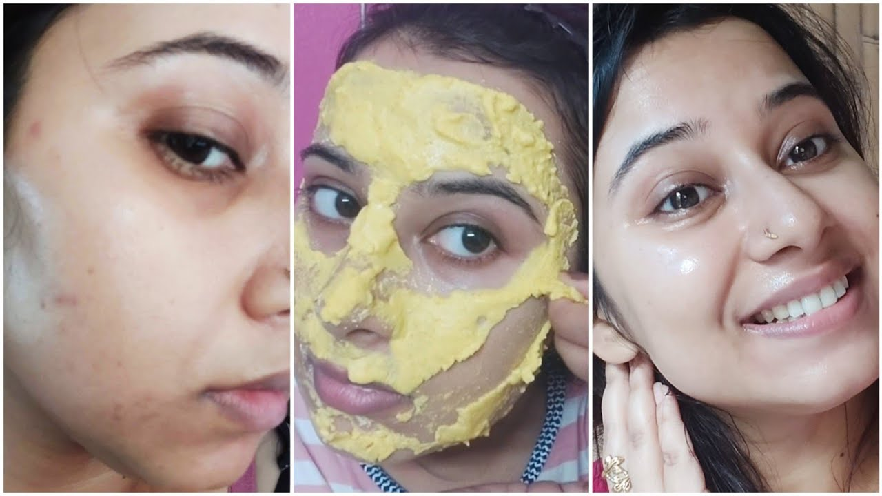 Esta receta con limón y otros dos ingredientes elimina las manchas oscuras y repara los daños del sol