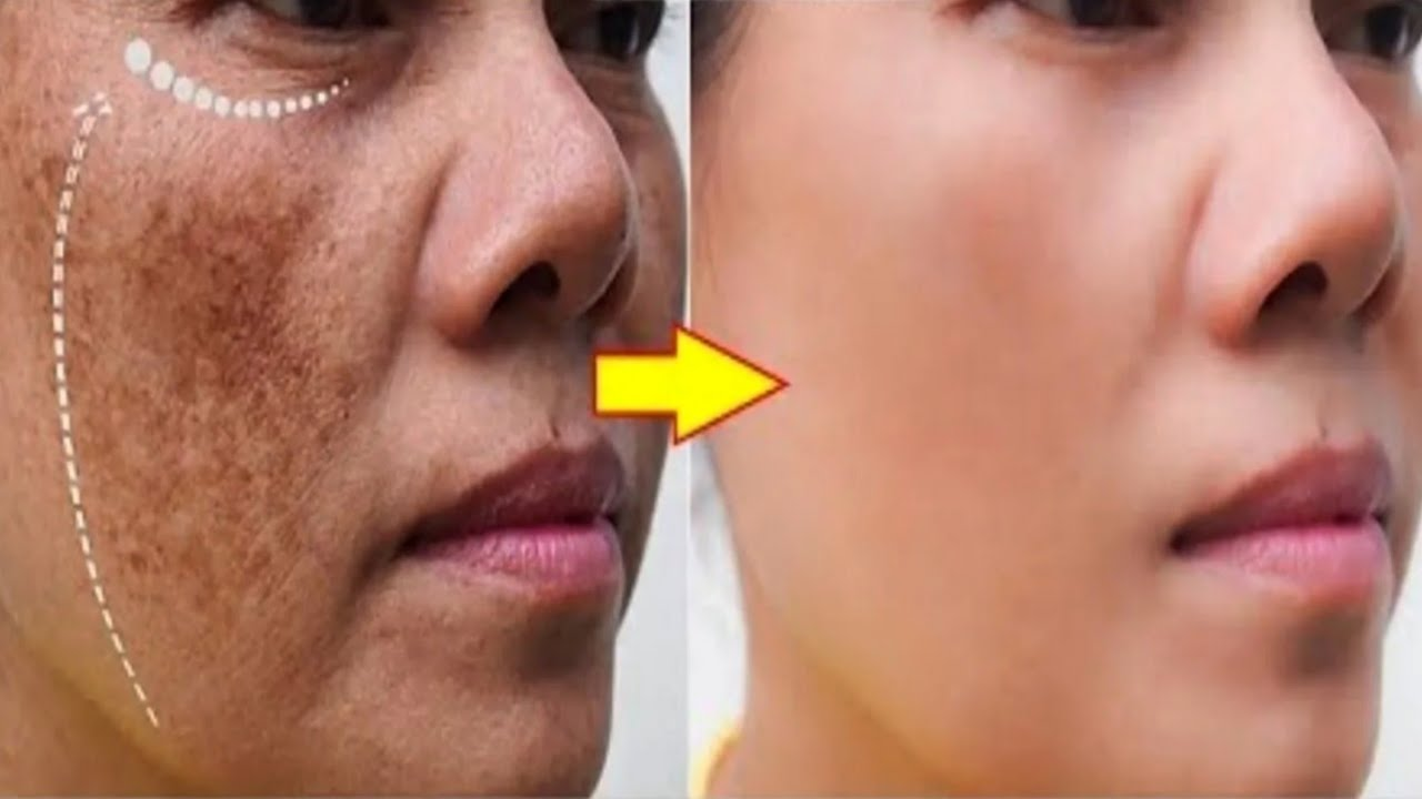 Una crema casera para una piel sublime sin manchas oscuras