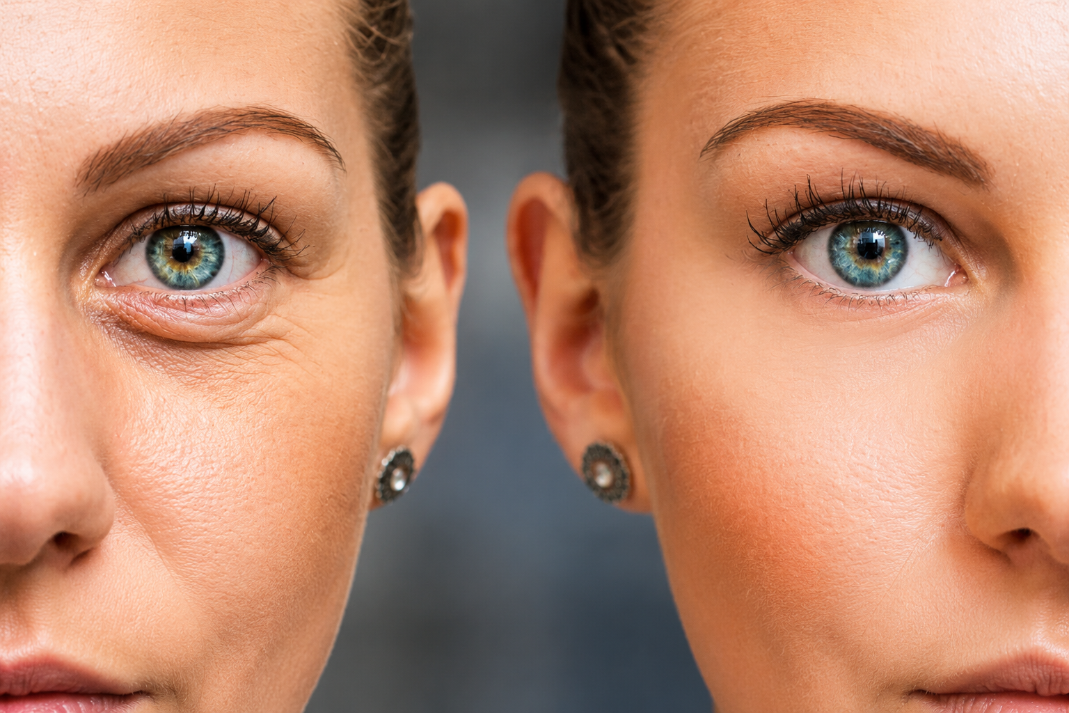 6 hábitos para rejuvenecer el contorno de los ojos