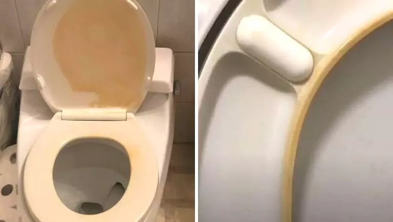 Así elimina las antiestéticas manchas amarillas en su asiento de inodoro. ¡Las manchas desaparecieron y el plástico volvió a ser blanco!